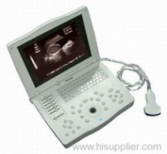 Laptop Ultrasound Scanner