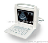 portable B ultrasound scanner