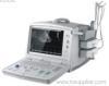 Digital ultrasound scanner
