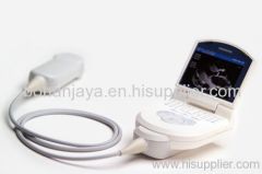 Siemens Acuson P10 Handheld Ultrasound Machine