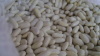 White Kidney Beans