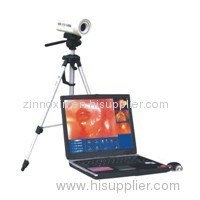 Digital Laptop Colposcope Work Station