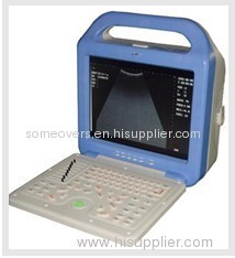 Laptop Ultrasound Scanner OSEN600L