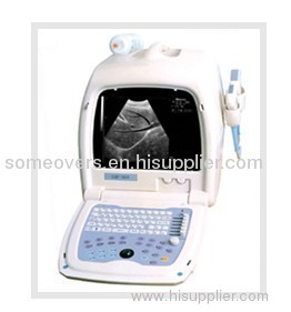 Portable Ultrasound Scanner OSEN800