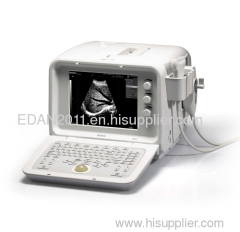 Ultrasound scanner DUS3