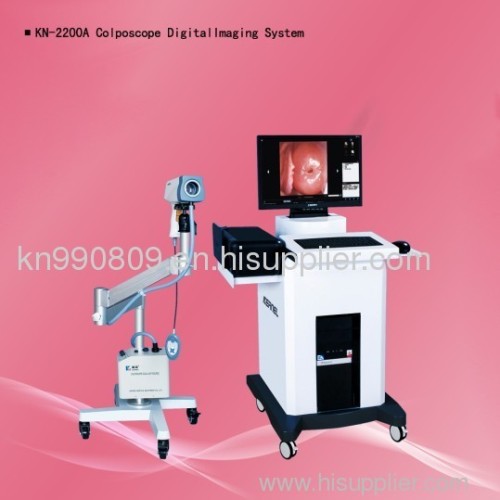Digital colposcope Imaging System