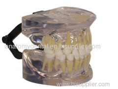 Transparent model of primary dentition
