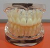 transparent model standard adult teeth