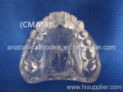 Wholesale - T-KM26B5 partial anodontia model , transparent dental model,dental model tooth model, oral ,Training