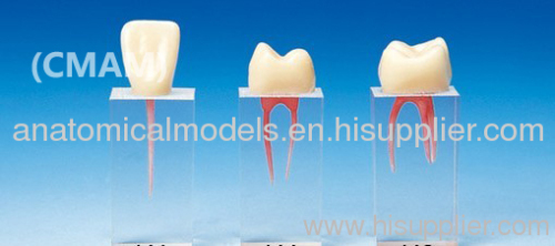 399,Root canal Model (S3 series),3pcs each set, Endodontics Area, Dental Training Products
