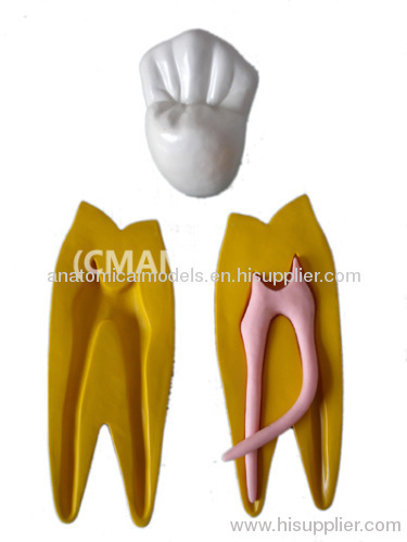 T-KM02A, 15x size permanent teeth model ,T-KM02A2