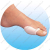 Toe Bunion Shield