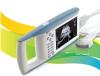 Digital PalmSmart Ultrasound Scanner