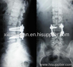 dry medical imaging x ray film used in medical printer