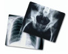 Medical x ray image film(XILONG)