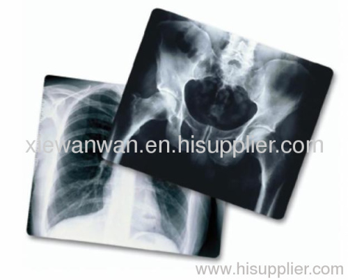 Medical x ray image film(XILONG)