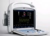 5000A Laptop Digital Color Doppler Ultrasound Scanner