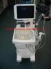 GE LOGIQ Alpha 200 Ultrasound