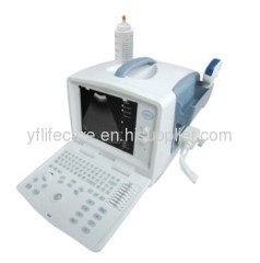 B-Ultrasound 10 Inch CRT Diagnostic Scanner