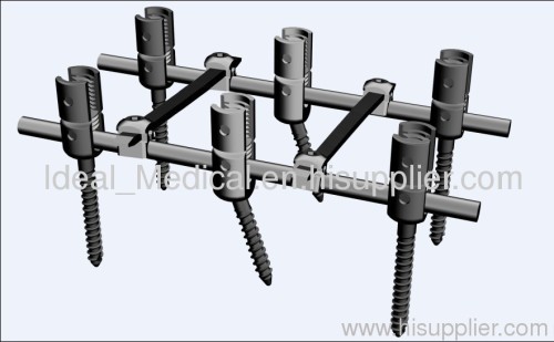 Spinal Internal Fixator Type 1