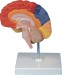 Human Brain, Half