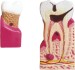 Model of Dental Pathology