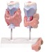 Model of Thyroid Disease
