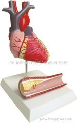 Human Heart Model