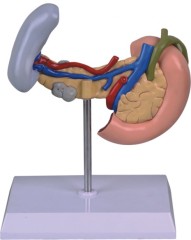 Diseased Model of Spleen
