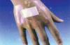 Elastic Non-Woven Wound Plaster Dressing, Medical Hypoallergenic Adhesive Dressing