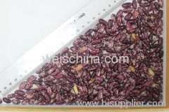 Purple Speckled Kidney Bean