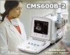 CMS600B-2 B-Ultrasound Diagnostic Scanner