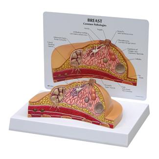 Human Breast Cross-Section Model,pharmaceutical promotion model