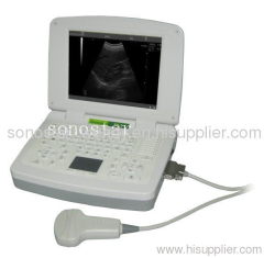 SS-3 Laptop Ultrasound B Scanner