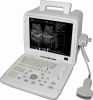 SS-4 Portable Full Digital Ultrasound Scanner