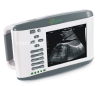 Portable SS-2 Ultrasound B Scanner(ultrasound,ultrasoni,black white,scanner)