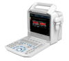 SS-1000 Portable Color Doppler System Ultrasound Machine