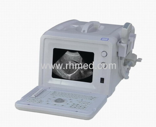 EXRH-300A Portable Ultrasound Scanner (Ordinary Type)