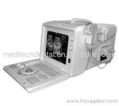 Ultrasound Scanner > MD2100