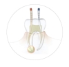 Dental Gutta Percha Points