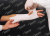 Orthopedic Fiberglass Splint AX415