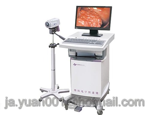digital video colposcopy system