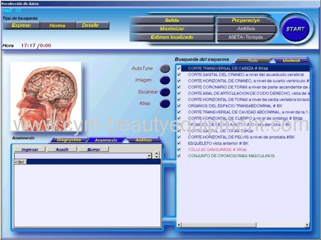 Spanish version 3D MRI CT health analyzer