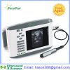 2. SS-2V Veterinary Ultrasound B Scanner