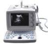 Portable Ultrasonic Diagnostic System (HY280A)