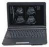 Laptop Diagnostic Ultrasound System With High-Resolution