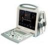 Portable Color Doppler Diagnostic Ultrasound System / Machine