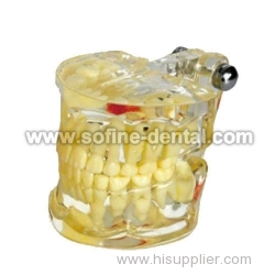 the Dental Teaching Model SF-DE-9010-3