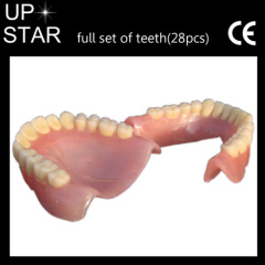 dental implant denture material