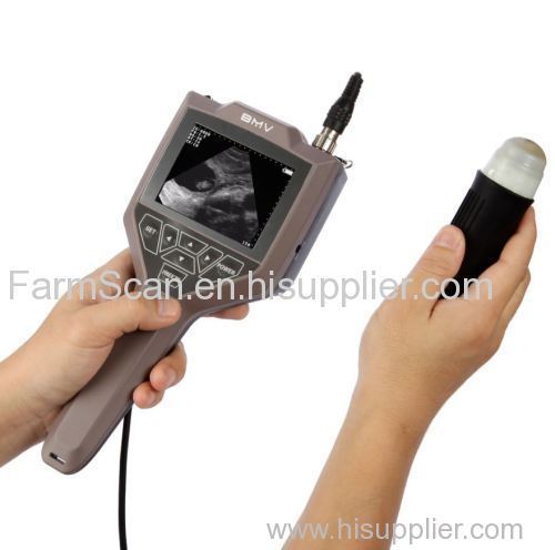 Chea Handheld Ultrasound Scanner